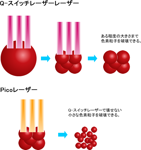 刺青インクの大きさ